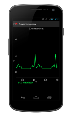 Android based Bluetooth Electrocardiogram 3 Android Bluetooth Electrocardiogram - Real-Time Charting Screen in Action